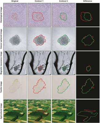 Two-dimensional segmentation fusion tool: an extensible, free-to-use, user-friendly tool for combining different bidimensional segmentations